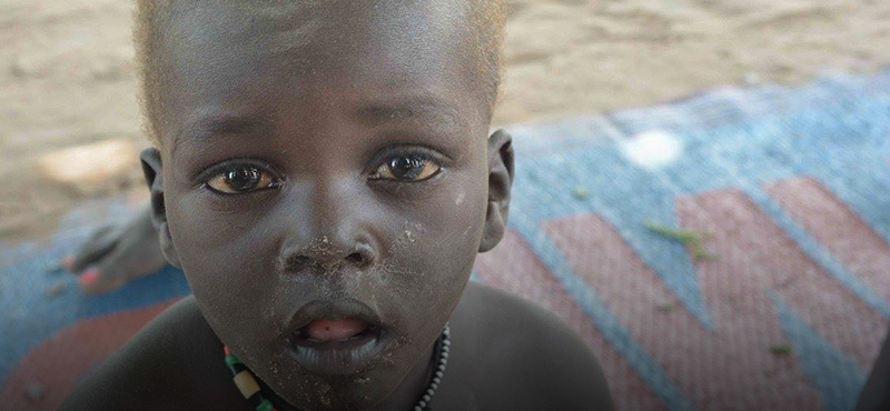 Dél-Szudán – Éhínség