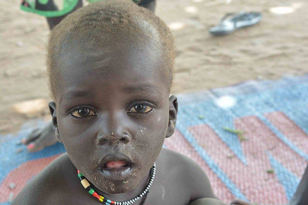 Dél-Szudán – Éhínség